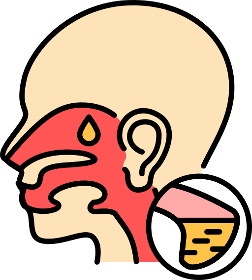 sinusitis